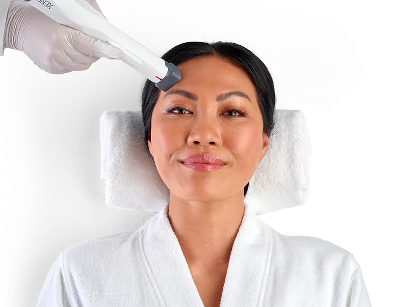 XERF skin tightening treatment